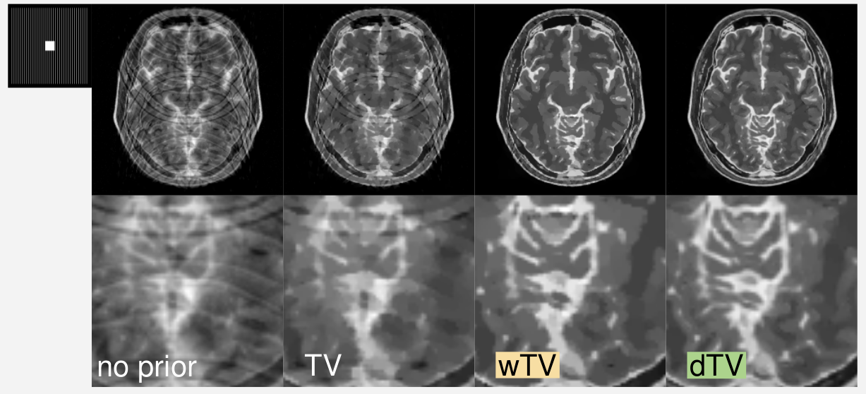 MRIMRI_results