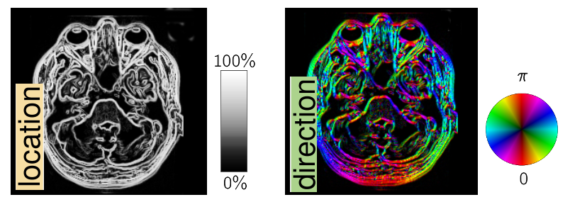 MRIMRI_structure