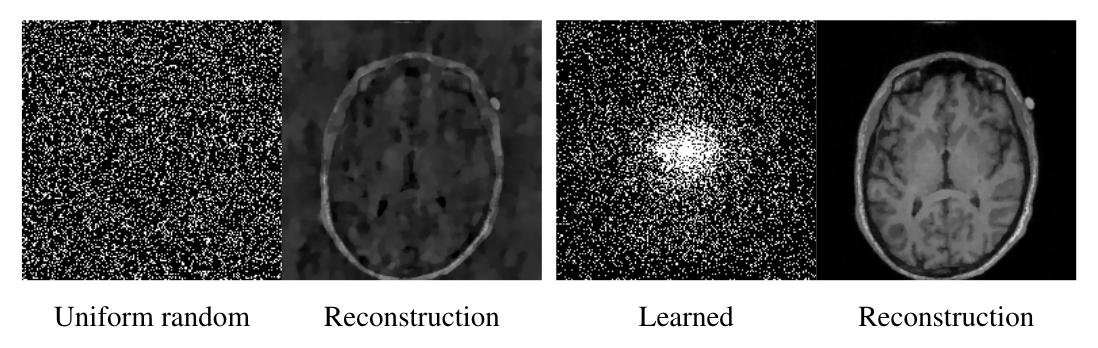 Learned sampling pattern for MRI